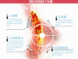 只需一分鐘，肩頸很輕松！——恒怡運(yùn)動(dòng)是有效的