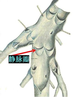 靜脈瓣與恒怡運(yùn)動(dòng)促通血液機(jī)理